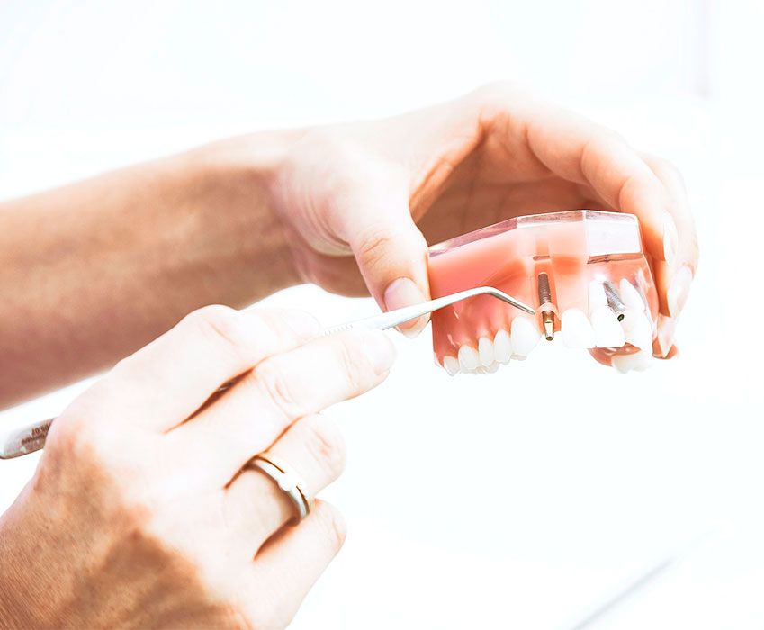 Laboratorio Dental Costa Verde Laboratorio Dental Costa Verde